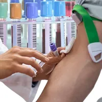 BIORRESONANCIA MAGNETICA CUANTICA