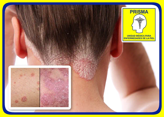 DERMATOLOGOS PRISMA